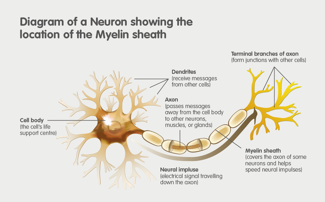 Metachromatic Leukodystrophy (MLD), diagram of a neuron showing the location of the Myelin sheath